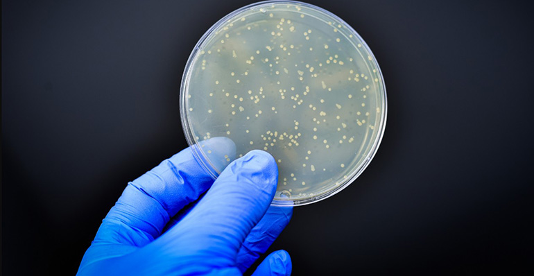 CSIC realiza una amplia secuenciación de los genes de resistencia bacterianos presentes en la cadena alimentaria